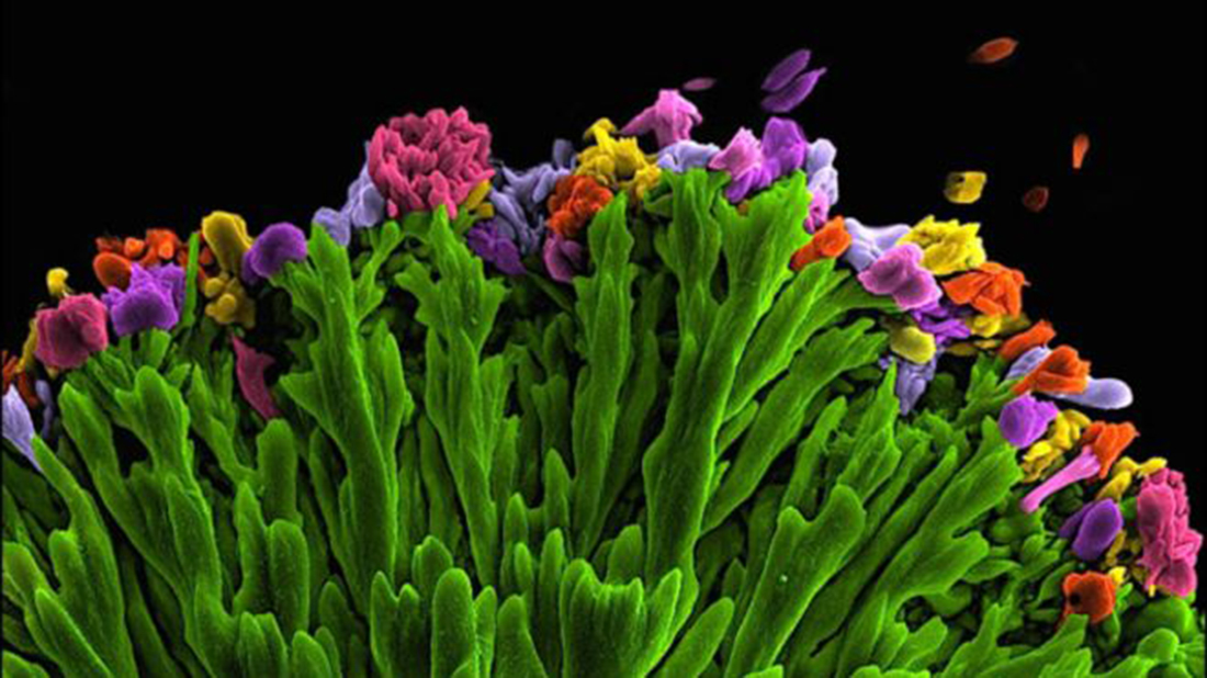 Kseniya Shuturminska ganó el primer premio con esta imagen microscópica de un mineral llamado apatita, que tituló "Ramo".