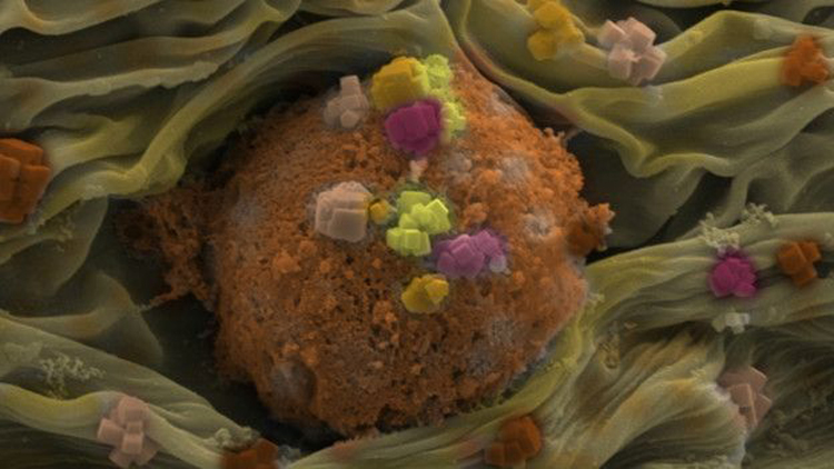 Dominic Collis presentó esta imagen de un fibroblasto humano (célula de la piel). Todas las fotos del concurso están ahora en exhibición permanente en el QMUL.