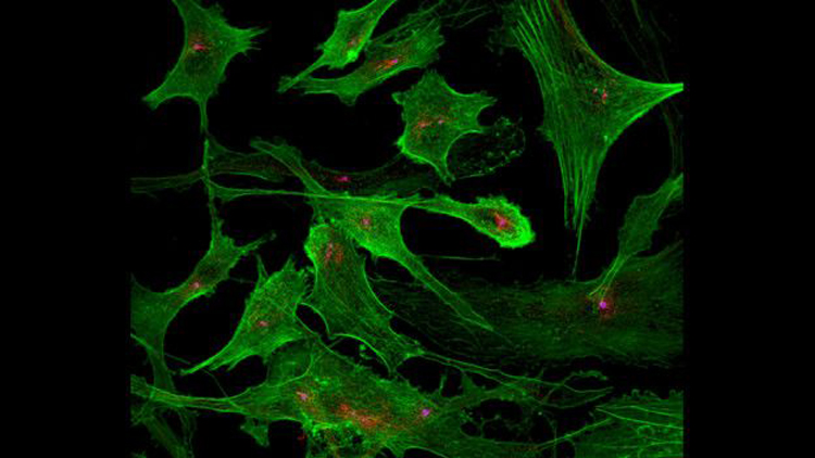 Dan Rowson creó una extraordinaria imagen de un tipo de células, oenocitos, teñidos por diferentes proteínas: actina (verde) y tubulina acetilada (rojo), y cuerpo basal (magenta).