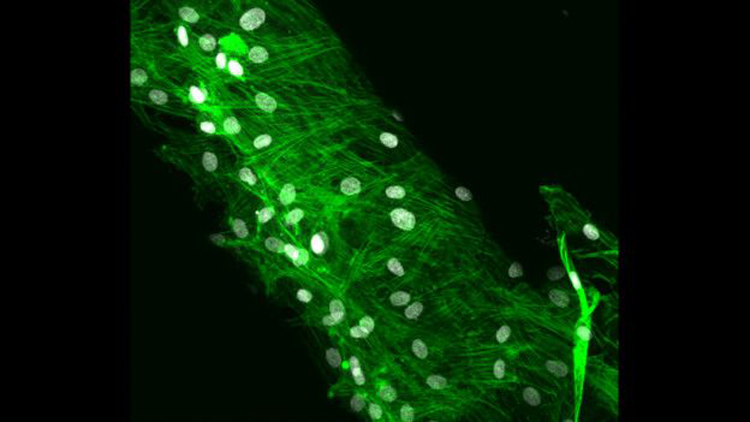Dharmesh Patel presentó esta imagen de una fibra con tenocitos bovinos. La fibra fue hecha al incorporar un tipo de molécula con células hechas fluorescentes. Así podemos ver el citoesqueleto de la célula y el núcleo, en verde y gris, respectivamente.