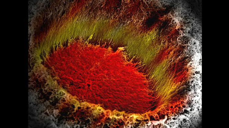 La fotografía de Elham Radvar de un micro-agujero en una membrana muestra una red fibrilar, resultado de la unión de dos moléculas de cargas opuestas. La imagen fue coloreada de forma artificial para simular el cráter de un volcán en erupción.