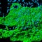 Esta imagen de Samantha Arokiasamy nos permite observar un tejido inflamado en el que se ven los vasos linfáticos (verde), rodeados por neutrófilos (azul), un tipo de glóbulos blancos. El título: "Cocodrilo en la lluvia".